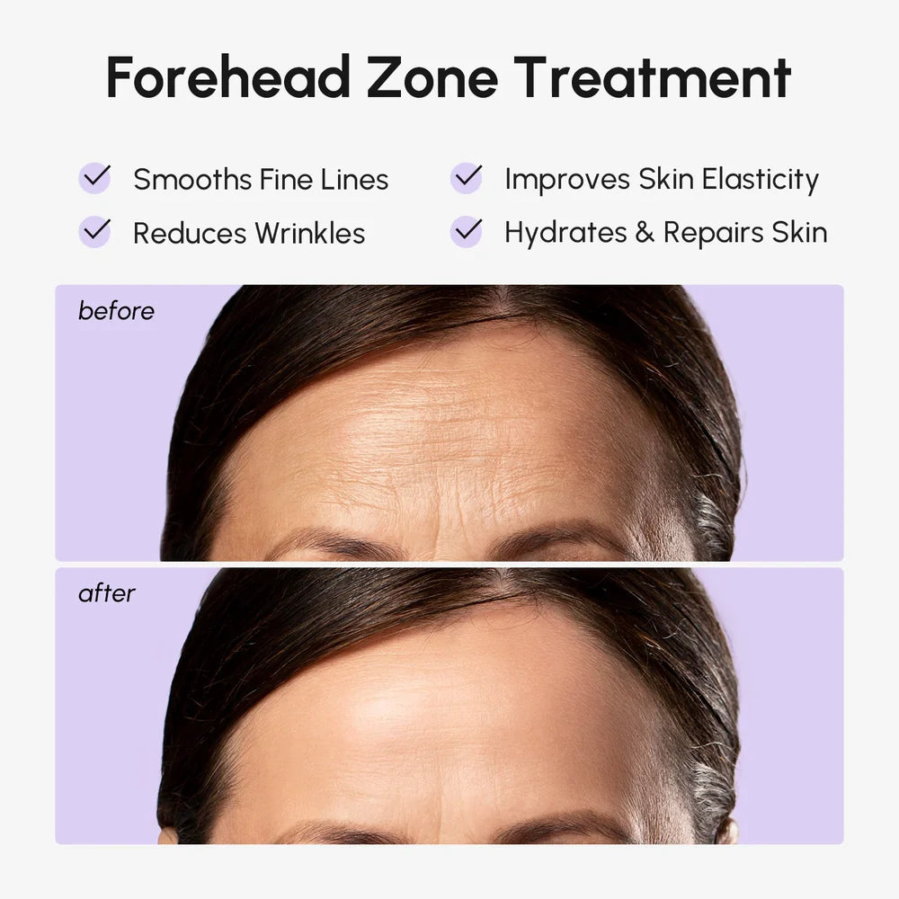 Hydrogel Forehead Wrinkle Patches – Overnight Smoothing Anti-Aging Patches