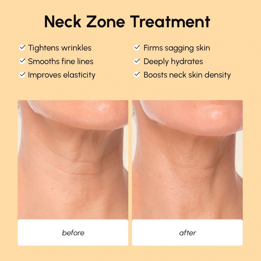 Neck Wrinkle Patches – Retinol & Collagen Firming Patches for Neck & Décolleté