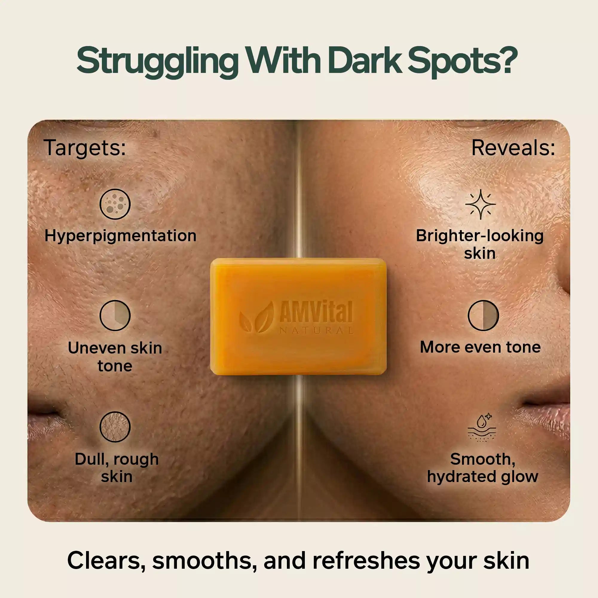 AMVital Turmeric Kojic Acid Soap Bar for Dark Spots & Uneven Tone